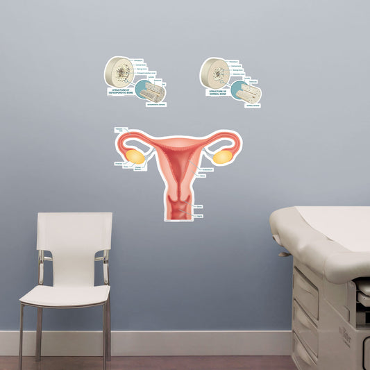 Body Part Chart:  Uterus        -   Removable     Adhesive Decal