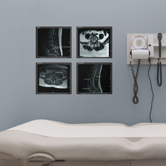 Body Part Chart:  Lumbar MRI Sagittal and Axial        -   Removable     Adhesive Decal