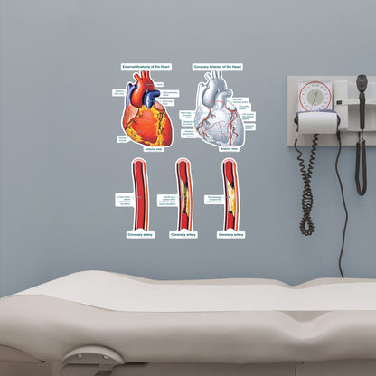 Body Part Chart:  Artery Blockages        -   Removable     Adhesive Decal