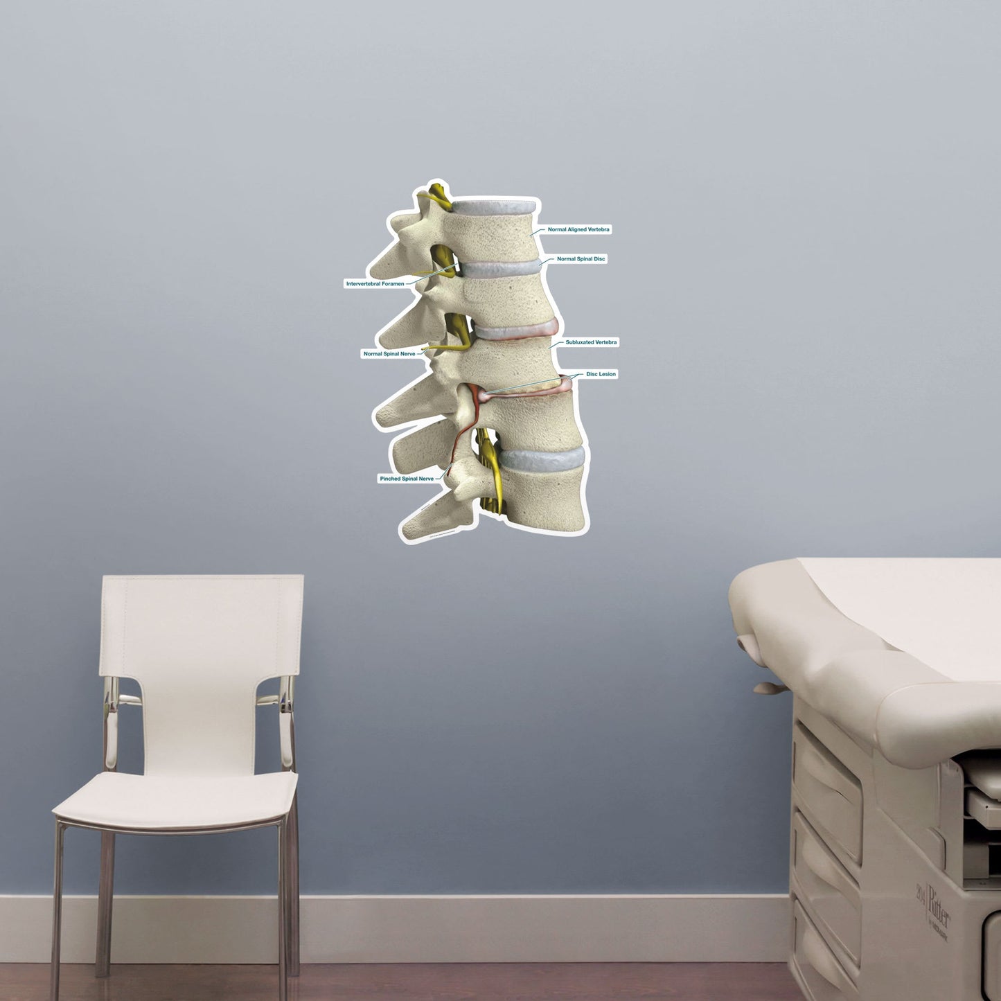 Body Part Chart:  Subluxation        -   Removable     Adhesive Decal